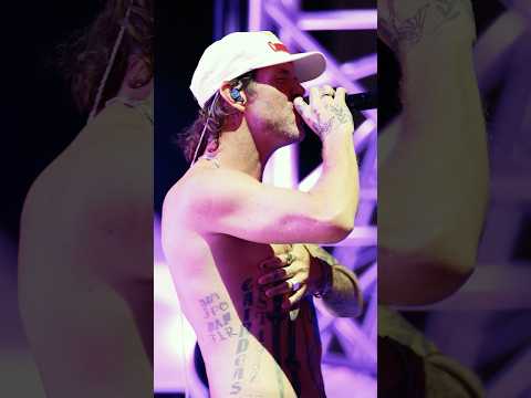 Three broken ribs… the show must go on!