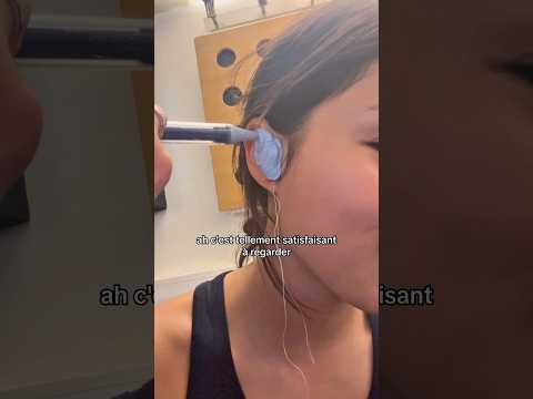 je voulais juste me faire mouler les oreilles à la base