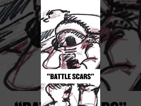“Battle Scars” is finally out now streaming globally, along with a new animated visualizer.  🌎✨