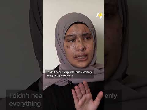 Survivors of Lebanon Pager Attacks, 1 Year Later