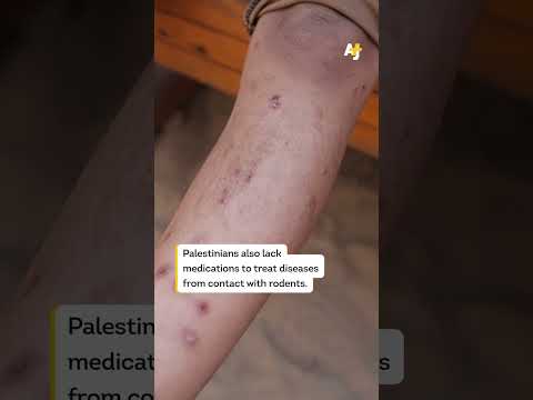 Snakes and Rats Are Taking Over Gaza’s Displacement Tents