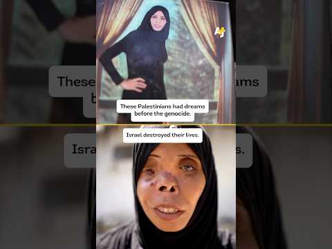 Israeli Violence Causes Thousands of Palestinians Life-Changing Injuries.