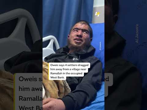 Palestinian Teen Says Settlers Kidnapped and Tortured Him