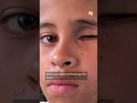 Palestinian Amputees Face Prosthetic Shortage