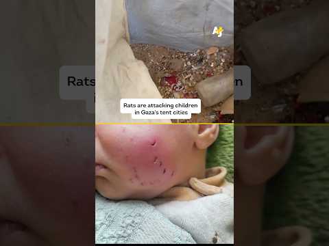 Rats Attack Palestinians in Gaza Tent Camps