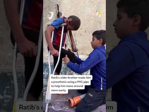 Palestinian Boy Loses Leg in Israeli Bombing, Makes Prosthetic From PVC Pipe