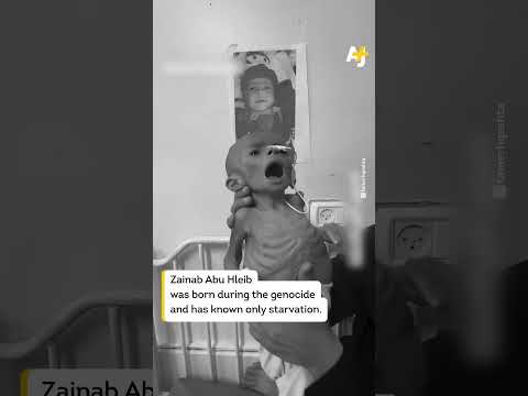 This is what Israel’s starvation of Gaza looks like